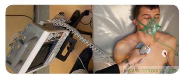 帶電極的醫(yī)院用除顫器。注意,患者身上有外部心電圖或心臟監(jiān)護(hù)儀,從胸部的白色圓片(電極)和導(dǎo)聯(lián)(線)可看出來。