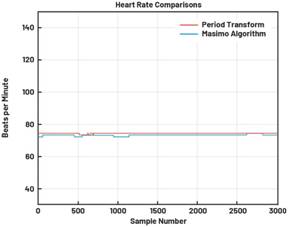 動(dòng)態(tài)離散周期變換技術(shù)突破：無ECG參考的生理信號(hào)精準(zhǔn)解析