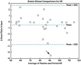 動(dòng)態(tài)離散周期變換技術(shù)突破：無ECG參考的生理信號(hào)精準(zhǔn)解析