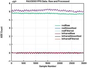動(dòng)態(tài)離散周期變換技術(shù)突破：無ECG參考的生理信號(hào)精準(zhǔn)解析